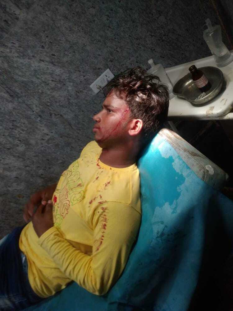 TMC goons brutally beat up a member of Congress’ student’s wing Chhatra Parishad